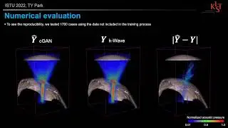 ISTU 2022: Simulation guided navigation system for transcranial focused ultrasound