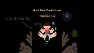 Manage it Like a Pro: Hand, Foot, and Mouth Disease.   #ParentingTips #ChildHealth #viralshort