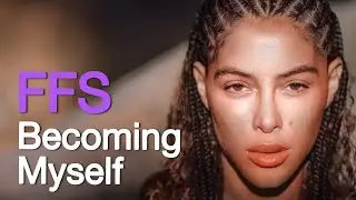 Brazilian Supermodel Marcella&rsquo;s Stunning FFS Transformation at Kamol Hospital