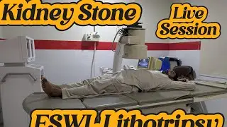 ESWL Lithotripsy Kidney Stone | Non invasive Treatment Lithotripsy | Kidney Stone Laser Operation