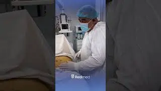 Bioimplant operatsiyasi