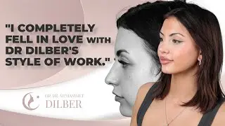 Simona's visit to Dr. Dilber 2 years after Rhinoplasty