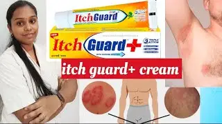 Itch guard cream l fungal infection l ringworm infection l uses , side effects l Rohini pharmacist l