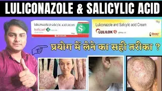 Double Strength Cream For Fungal Infection 😱| Luliconazole And Salicylic Acid Cream |Lulican S cream