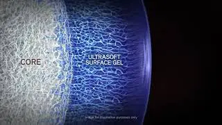 Alcon Dailies Total 1 - Water Gradient Technology Part 2 - Vision Works