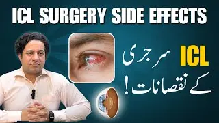 ICL Surgery Side Effects What You Need to Know Before the Procedure