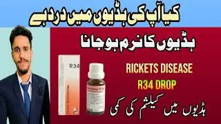 R 34 - Calcossin uses in urdu | Bone Weakness, Calcium Deficiency in Bone | Overview in Hindi