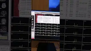 spectroscopy process