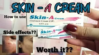 Skin A cream review | tretinoin cream | how to use skin a cream/uses , side effects | Part 2