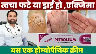 Petroleum ointment homeopathic uses | Sbl petroleum cream uses in hindi