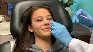 Tear trough eye bag correction with Volbella