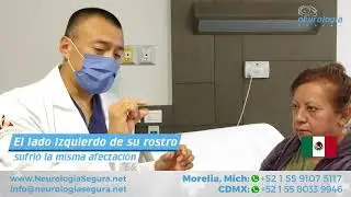 Neuralgia del trigémino bilateral de México se opera de ambos lados en Neurología Segura