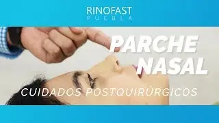 Parche nasal Rinofast Puebla
