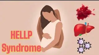 HELLP Syndrome ; Hemolysis, Elevated Liver enzymes, Low Platelet count, Pregnancy complication