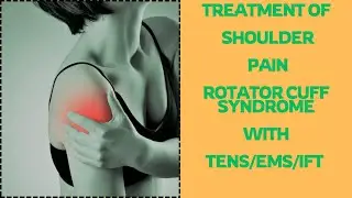SHOULDER PAIN/ROTATOR CUFF SYNDROME/PHYSIOTHERAPY WITH TENS/EMS/INTERFERENTIAL THERAPY MACHINE