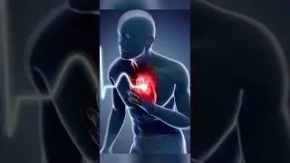 What is Angina? Symptoms and Warning Signs Explained