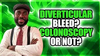 Colonoscopy or Not? A Diverticular Bleed Case