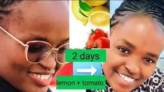 Lemon + Tomato to smoothen your skin overnight // How to remove pimples & wrinkles naturally at home