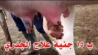 وداعا للجدري عند الابقارج جبتلكم العلاج السحري اللي الدكاتره خبوه عنكم طول السنين ب ١٥ جنيه بس ياناس