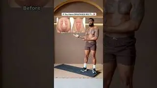 Do you have DIASTASIS RECTI?❌ (Do This✅)