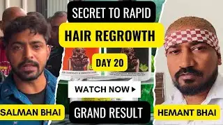I Tried Rapid Hair Regrowth In 15 Days #captureride #haircare #jamalgota