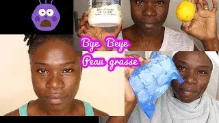 Peau grasse: Bye bye peau huileuse, fini les pores dilatés et surtout adieu boutons et tâches