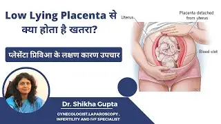Low Lying Placenta क्या है ? | LOW LYING PLACENTA से प्रेगनेंसी में  क्या हो सकता है ?