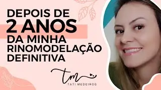 MINHA RINOMODELAÇÃO DEFINITIVA - PACIENTE MODELO | 2 ano após