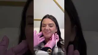 Facial Symmetry