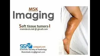 28- Imaging of soft tissue tumors (I) - Prof  Mamdouh Mahfouz