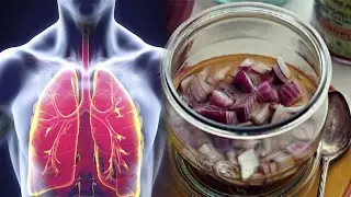 Sekreti i gjyshes: Kjo kur&euml; pastron t&euml;r&euml;sisht mushk&euml;rit&euml; p&euml;r 3 dit&euml;, ja receta