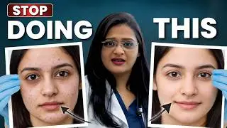 Six Reasons Your Acne Won&rsquo;t Go Away (And How To Fix It Naturally!) | Clear Skin Clinic, Pune