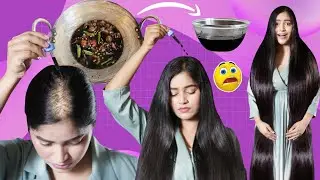 I Applied Just 1 Drop Of This Diy & Got Massive Hair Growth गंजे सर पर बाल वापस आ गए MostPowerfulDiy