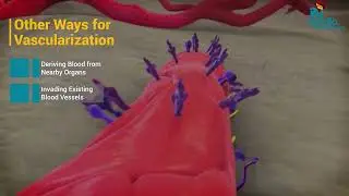 Tumor Vascularization in Lung Cancer & Treatment Options | Dr. Vikram Maiya | Apollo Hospitals