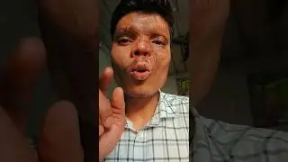 कुत्ते ने काटा दोस्त को #bome #funny #comedy