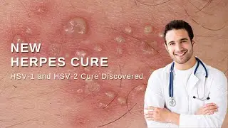 New Herpes treatment and HSV Cure | The Elementary Info