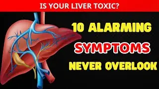 Is Your Liver Toxic? 10 Alarming Symptoms You Should Never Overlook| HEALTHY START
