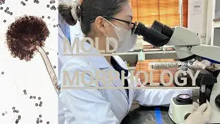 Mold Morphology | Lab Volg | The Observation of Mold Morphology under Microscope 👩🏻&zwj;🔬🔬🦠🧪