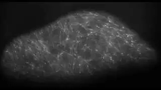 TIRF microscopy of EB1-GFP in Arabidopsis Leaf Cells