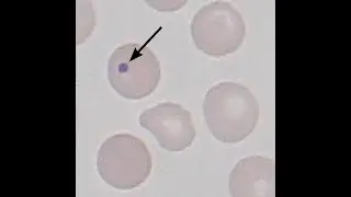 What Do Howell-Jolly bodies indicate?