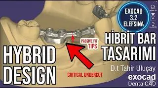 Exocad Offset metal tasarım nasıl yapılır...