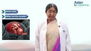 Bow Legs in Infants & Toddlers | Dr. Kavitha Bhat | Paediatric Endocrinology | Aster RV