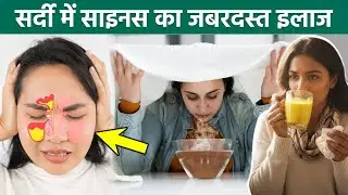 Sinus Treatment Home Tips: साइनस का इलाज,लक्षण और उपचार | Sardi Me Sinus Ka Ilaj |Boldsky