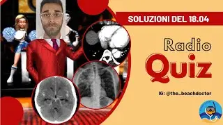 #radioquiz - soluzioni del 02.05