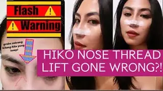 HIKO NOSE LIFT EXPERIENCE AT PINKWORK AFTER 2 MONTHS (do’s and don’t, price reveal) | VLOG 79