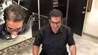 Thinning Hair Men Before and After video HairCubed ® Secret You❤️
