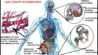 Lead Poisoning Effects on Blood and bone marrow; disrupting essential processes
