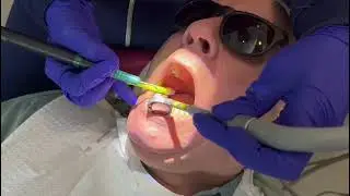 Nu-Bird HVE demo dental hygiene