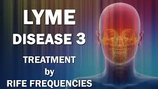 Lyme Disease 3 - RIFE Frequencies Treatment - Energy & Quantum Medicine with Bioresonance