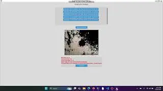 🚨 Early Cancer Detection Saves Lives! Free AI Skin Cancer Detector App &ndash; Try It Now! ✅📲 #python